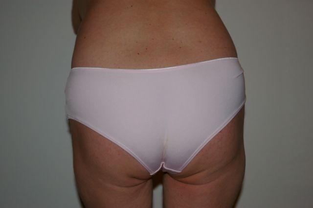 Versautes für alles und jeden?? - Getragene Hoeschen - Wien